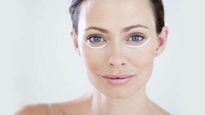 Top des astuces naturelles pour réduire ses cernes 