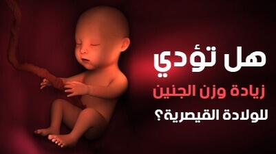 هل تؤدي زيادة وزن الجنين للولادة القيصرية؟