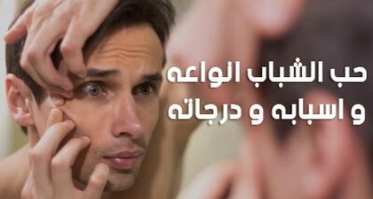 حب الشباب انواعه و اسبابه و درجاته