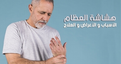 هشاشة العظام : الأسباب و الأعراض و العلاج