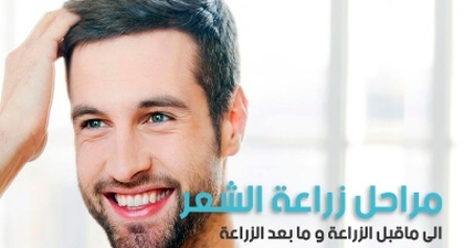 مراحل زراعة الشعر