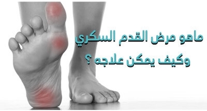 ماهو مرض القدم السّكّري pied diabétique وكيف يمكن علاجه ؟