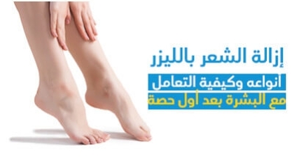 إزالة الشّعر باللّيزر : أنواعه وكيفيّة التّعامل مع البشرة بعد أوّل حصّة