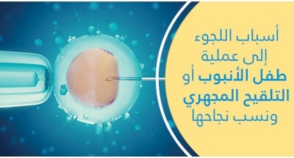 أسباب اللّجوء إلى عمليّة طفل الأنبوب أو التّلقيح المجهري ونسب نجاحها
