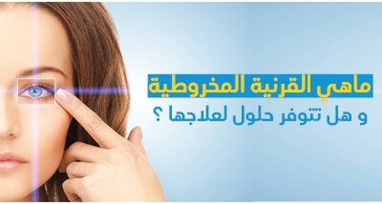 ماهي القرنيّة المخروطيّة و هل تتوفّر حلول لعلاجها ؟ 