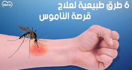 6 طرق طبيعية لعلاج قرصة الناموس