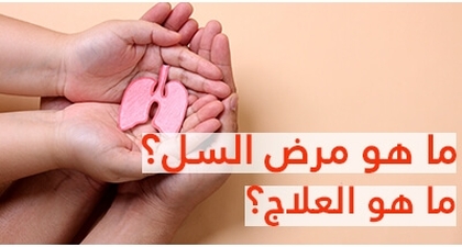  مرض السل ما هو العلاج