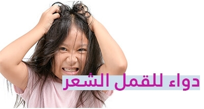 دواء للقمل الشعر