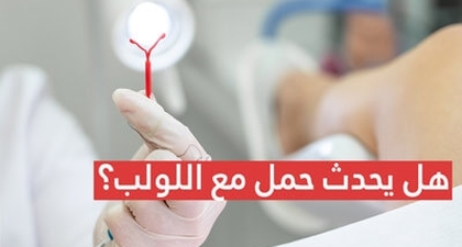 هل يحدث حمل مع اللولب