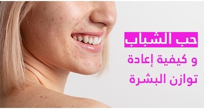 حب الشباب و كيفية إعادة 