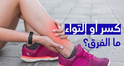 كسر أو التواء ما الفرق