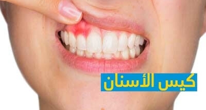 كيس الأسنان