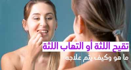 تقيح اللثة أو التهاب اللثة ما هو وكيف يتم علاجه