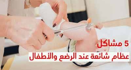 5 مشاكل عظام شائعة عند الرضع والأطفال