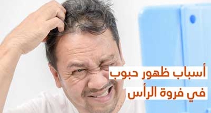 أسباب ظهور حبوب في فروة الرأس