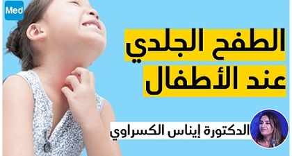 الطفح الجلدي عند الأطفال