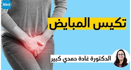 تكيس المبايض