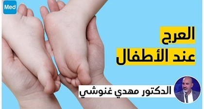 العرج عند الأطفال