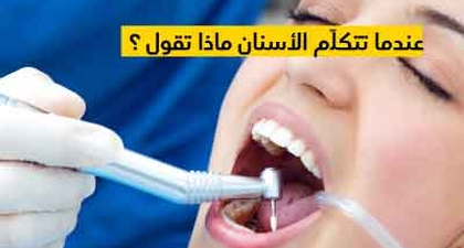 عندما تتكلّم الأسنان ماذا تقول ؟