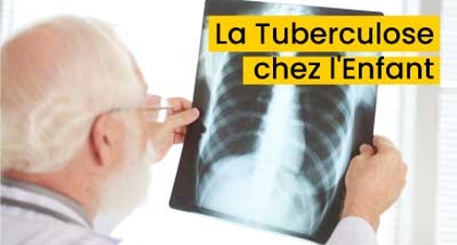 La Tuberculose chez l'Enfant