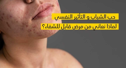  حب الشّباب والأذى النّفسي لماذا نعاني من مرض قابل للشّفاء؟