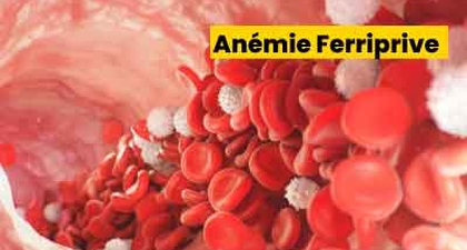 Anémie Ferriprive