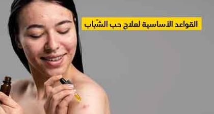 القواعد الأساسية لعلاج حب الشّباب