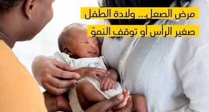 مرض الصعل... ولادة الطّفل صغير الرأس أو توقف النموّ