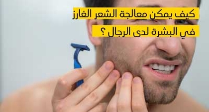 كيف يمكن معالجة الشعر الغارز في البشرة لدى الرجال ؟