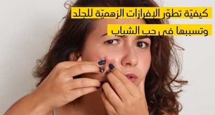   كيفيّة تطوّر الإفرازات  الزهميّة للجلد  وتسببها في حب الشباب