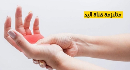 متلازمة قناة اليد
