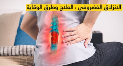 الانزلاق الغضروفي : العلاج وطرق الوقاية