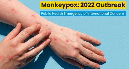 Monkeypox: 2022 Outbreak