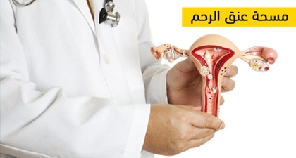 مسحة عنق الرحم