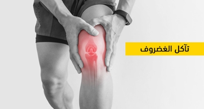 تآكل الغضروف