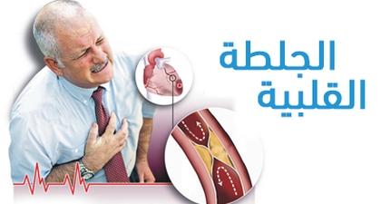 الجلطة القلبية