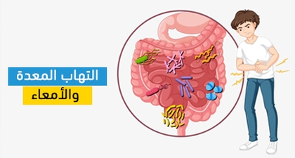 التهاب المعدة والأمعاء