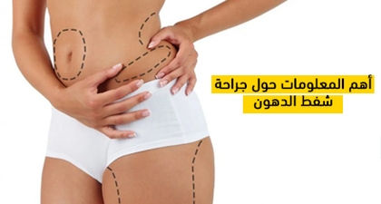 أهم المعلومات حول جراحة شفط الدهون