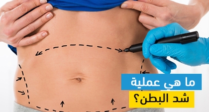 ما هي عملية شد البطن؟