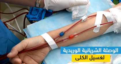 الوصلة الشريانية الوريدية لغسيل الكلى