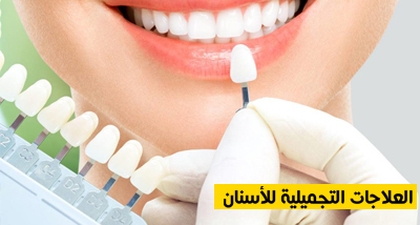 العلاجات التجميلية للأسنان