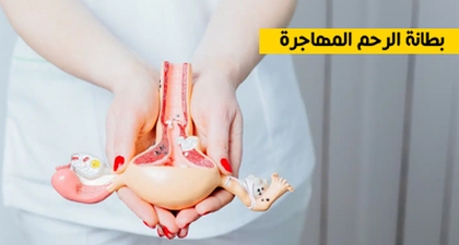 بطانة الرحم المهاجرة