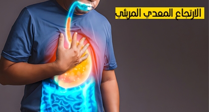 الارتجاع المعدي المريئي