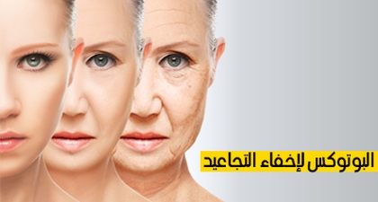 البوتوكس لإخفاء التجاعيد