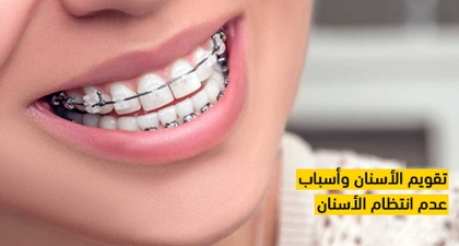 تقويم الأسنان وأسباب عدم انتظام الأسنان