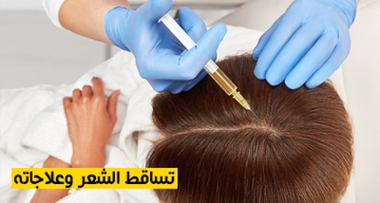تساقط الشعر وعلاجاته
