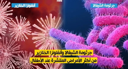 جرثومة الشيغالا وأنفلونزا الخنازير من أكثر الأمراض المنتشرة عند الأطفال