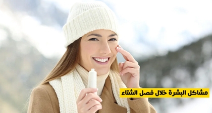 مشاكل البشرة خلال فصل الشتاء