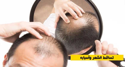 تساقط الشعر وأسبابه