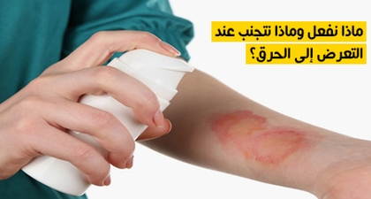 ماذا نفعل وماذا نتجنب عند التعرض إلى الحرق